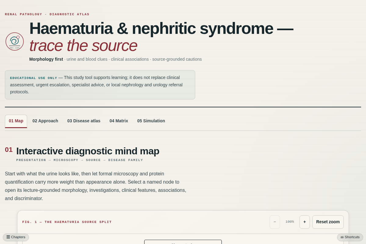 Preview of Haematuria & Nephritic Syndrome: Interactive Diagnostic Mind Map